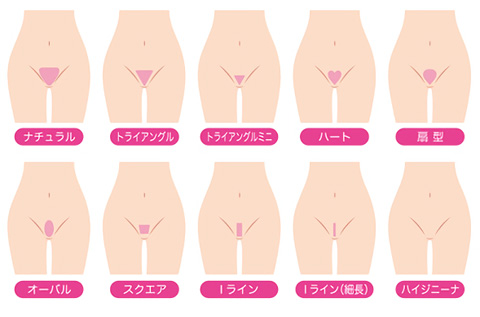 VIOの形