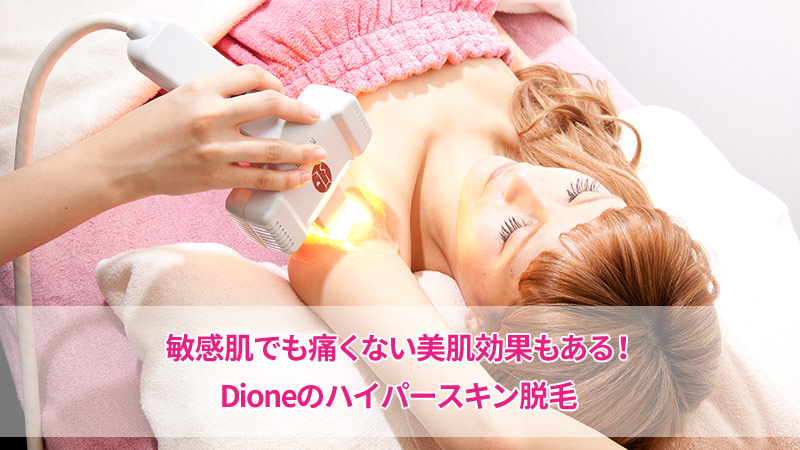 ディオーネ