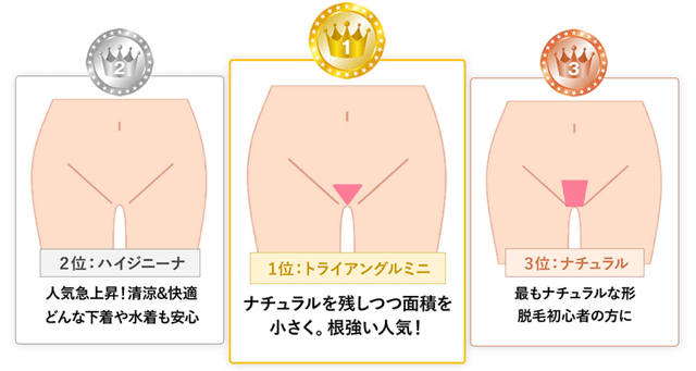 Vラインの形