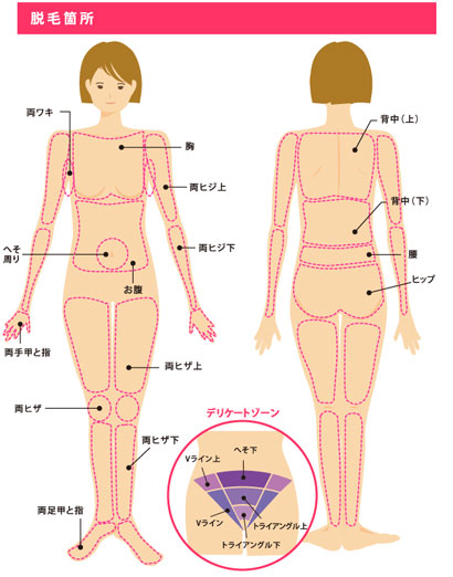 脱毛できる部位