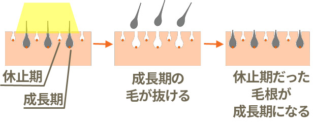 毛周期の変遷