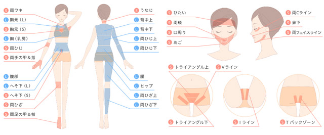 脱毛部位