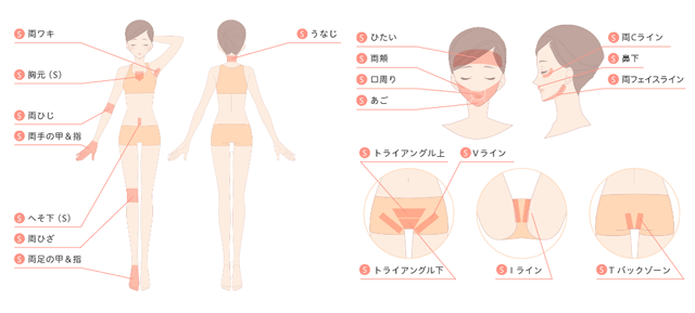 Sパーツ