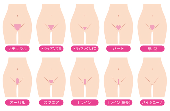 VIOの形をデザイン