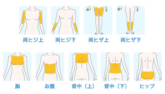 Lパーツの対象部位