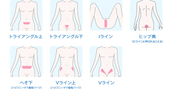 ハイジニーナ7VIO脱毛コースの対象部位