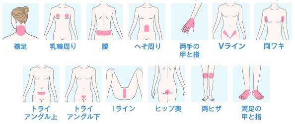 Sパーツの対象部位