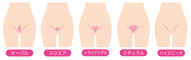 VIO脱毛の形