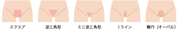Vラインの形