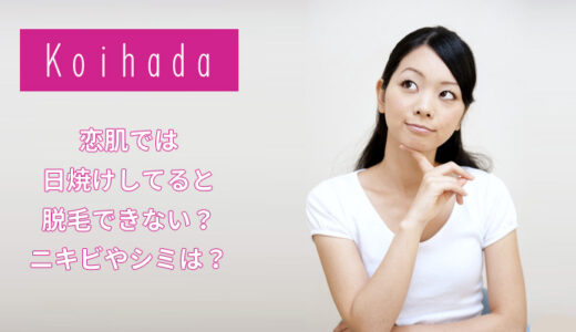 恋肌では日焼けしていると脱毛できない？ニキビやホクロなどは？