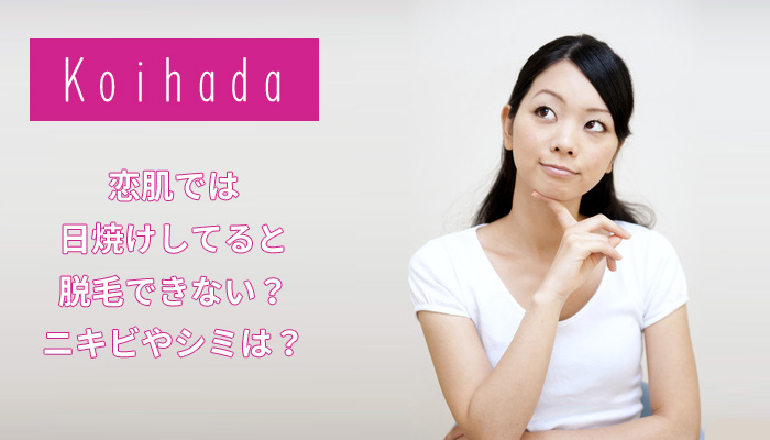恋肌では日焼けしていると脱毛できない？