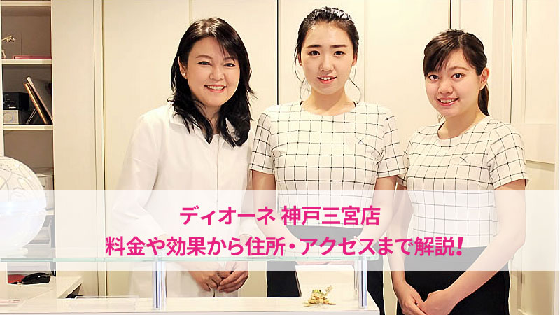 ディオーネ神戸三宮店の口コミ