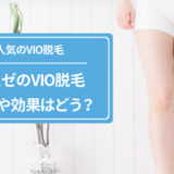 ミュゼプラチナムのVIO脱毛
